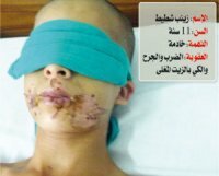 دفاع الطفلة زينب الشطيط يلتمس من هيئة المحمكة معاينة حالتها والحكم بعدم الاختصاص