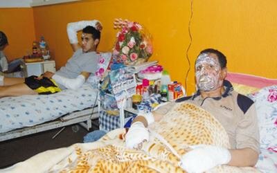 لحكم السابق جمال بلقاسمي بمستشفى الفارابي بعد إصابته رفقة ابنه بحروق