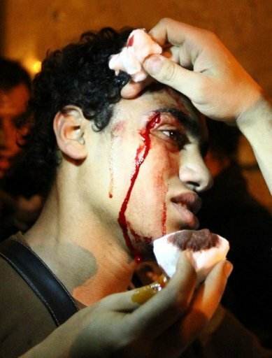 أي شرف بقي لزعيم النظام المصري يخشى عليه بعد المذبحة الرهيبة التي ارتكبها في حق شعبه؟