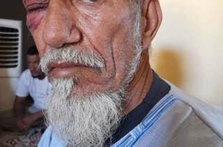 عصابة تحت حماية ميليشيات « بوليساريو » تعتدي على شيخ كبير وابن أخته بالضرب والجرح وتسرق أموال الأسرة بمخيمات تندوف