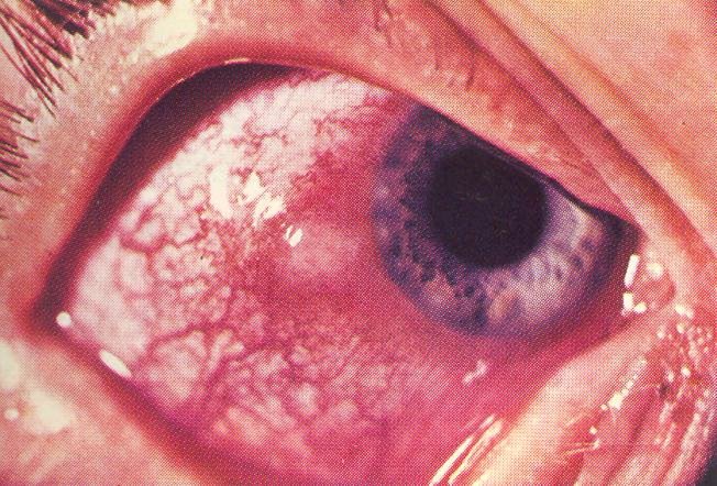 حملة طبية بفضاء الطفل ـ موسى بن نصير ـ بحي الفتح لازاري