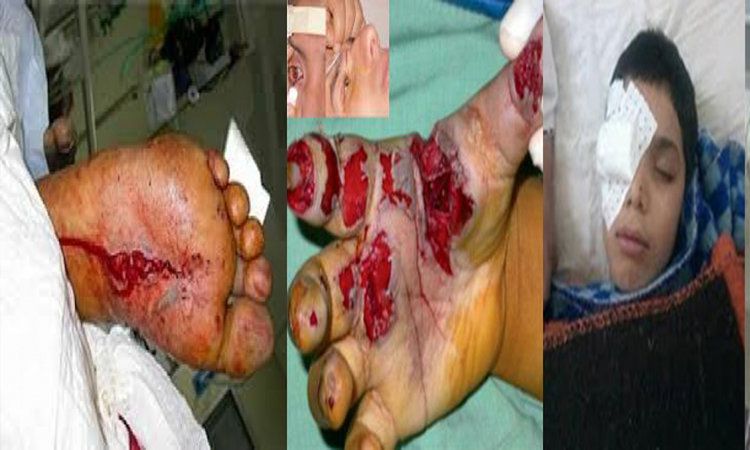 تشكل خطرا على الأطفال أدت ببعضهم إلى مستعجلات، استفحال ظاهرة المفرقعات والشعب النارية احتفالا بعيد المولد النبوي بوجدة