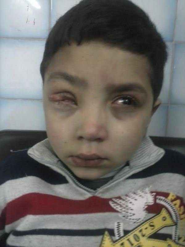 نداء انساني عاجل لانقاذ طفل فقير