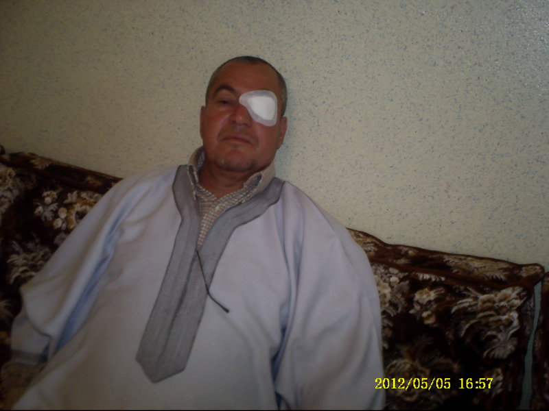 بالشــــفـاء العــاجـــل للزميل الصحفي الحاج محمد الزروقي.