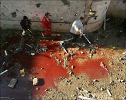 من مجازر زمن الذل العربي ….صور من مجزرة بيت حانون …. وللقراء العليق